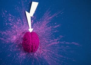 neuroplasticnost 